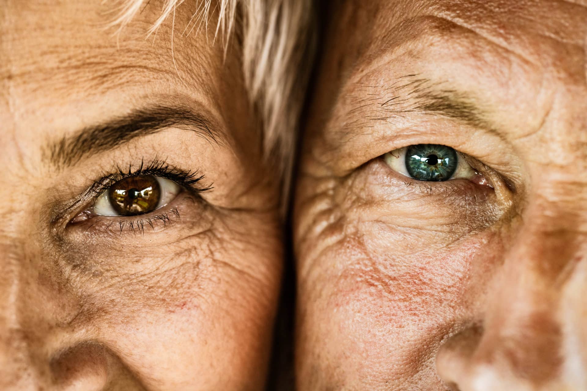 Chirurgie esthétique ou réparatrice des paupières supérieures et ou inférieures visant à corriger les paupières tombantes et les poches sous les yeux pour un regard plus jeune et reposé. Un geste sur le sourcil peut être associé.